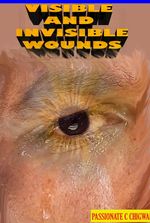 VISIBLE AND INVISIBLE WOUNDS